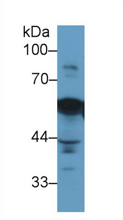 Vimentin (VIM) Human Monoclonal Antibody
