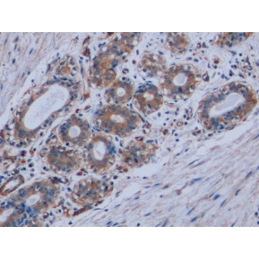 Vimentin (VIM) Human Monoclonal Antibody