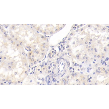 Integrin Beta 1 (ITGb1) Human Monoclonal Antibody