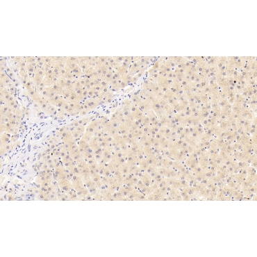 Integrin Beta 1 (ITGb1) Human Monoclonal Antibody