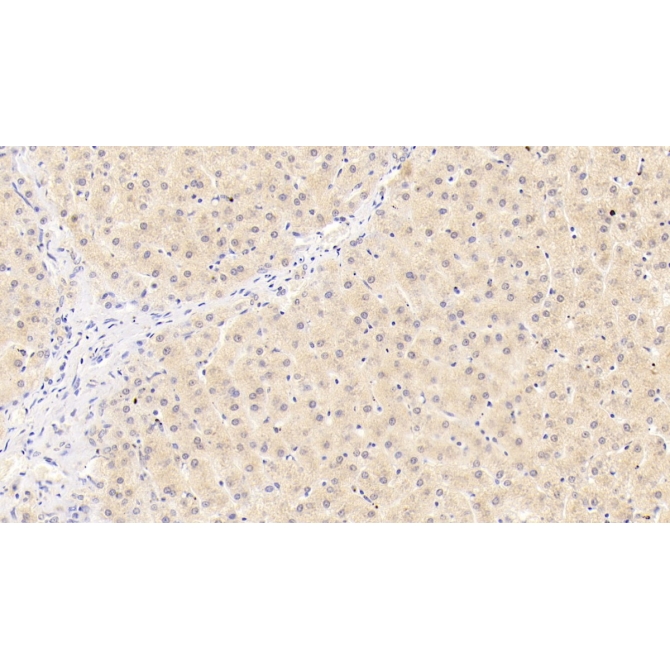 Integrin Beta 1 (ITGb1) Human Monoclonal Antibody