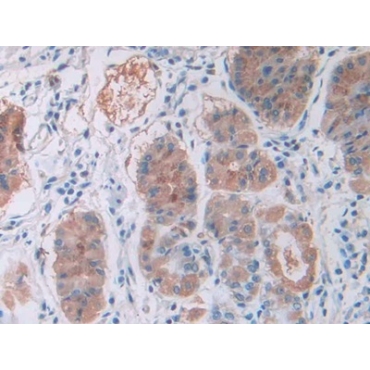 Cholecystokinin 8 (CCK8) Human Monoclonal Antibody
