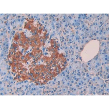 Cholecystokinin 8 (CCK8) Human Monoclonal Antibody
