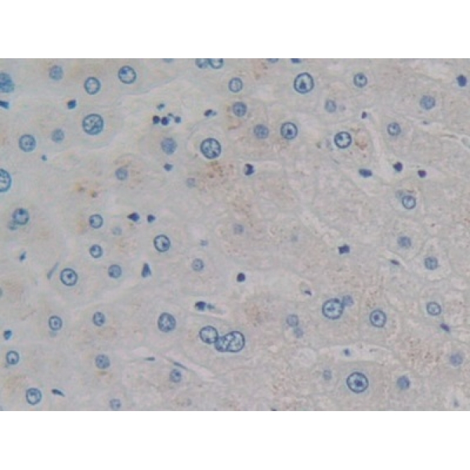 Cholecystokinin 8 (CCK8) Human Monoclonal Antibody