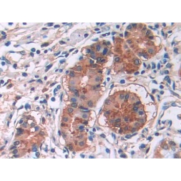 Cholecystokinin 8 (CCK8) Human Monoclonal Antibody