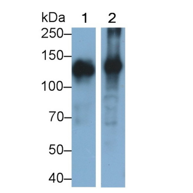 Alanine Aminopeptidase (AAP) Human Monoclonal Antibody