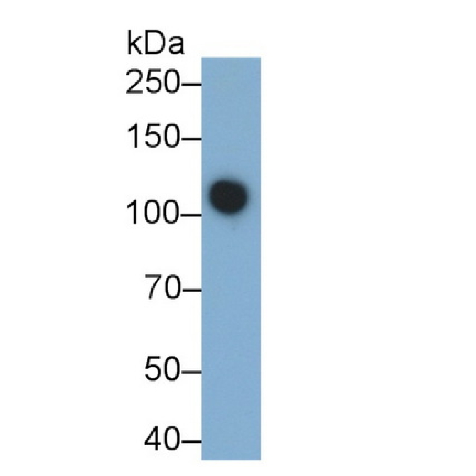 Alanine Aminopeptidase (AAP) Human Monoclonal Antibody