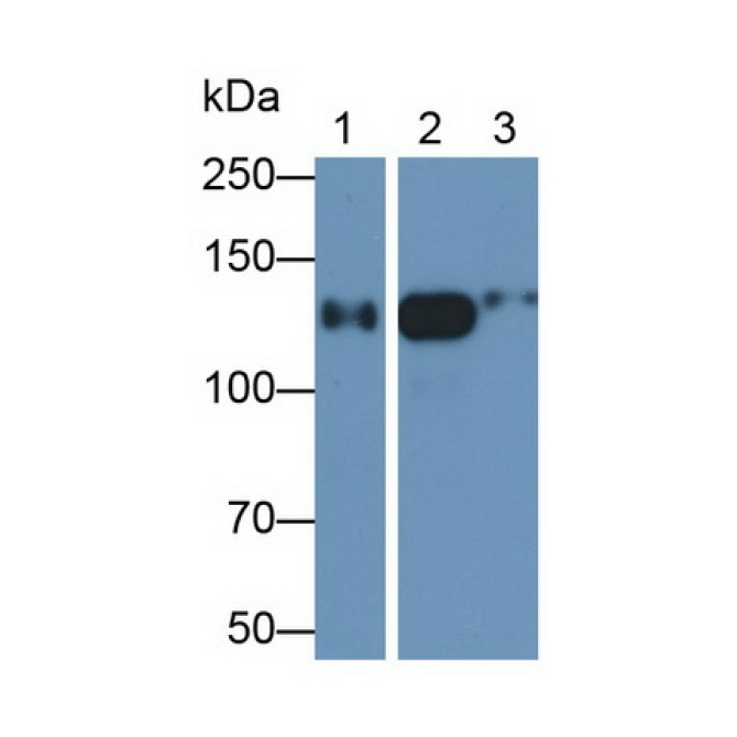 Alanine Aminopeptidase (AAP) Human Monoclonal Antibody