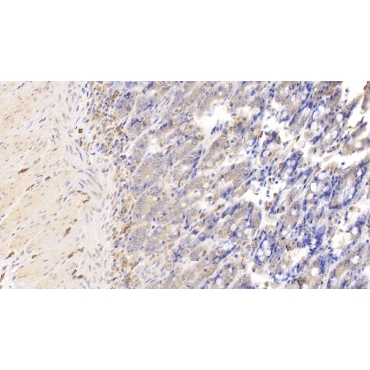 Tryptase (TPS) Human Monoclonal Antibody