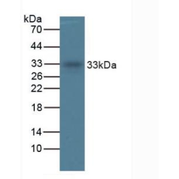 Tryptase (TPS) Human Monoclonal Antibody