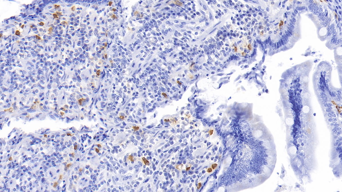 Tryptase (TPS) Human Monoclonal Antibody
