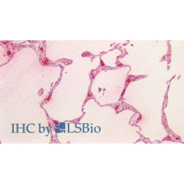 Tryptase (TPS) Human Monoclonal Antibody