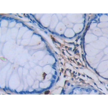 Tryptase (TPS) Human Monoclonal Antibody