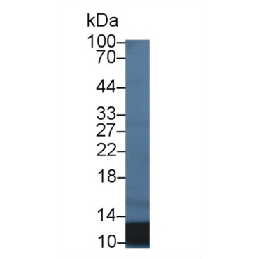 S100 Calcium Binding Protein A12 (S100A12) Human Monoclonal Antibody