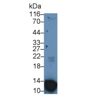 S100 Calcium Binding Protein A12 (S100A12) Human Monoclonal Antibody