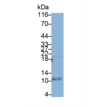 S100 Calcium Binding Protein A12 (S100A12) Human Monoclonal Antibody