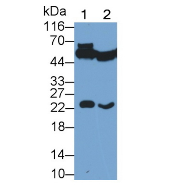 Glutathione S Transferase Pi (GSTp) Hamster (Chinese hamster) Monoclonal Antibody