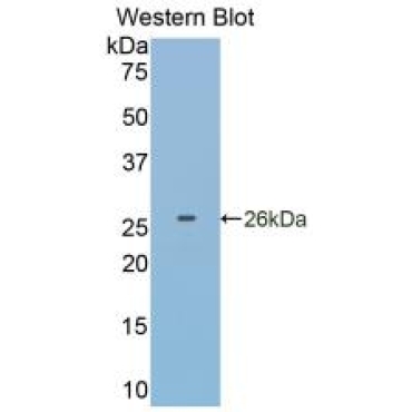 Glutathione S Transferase Pi (GSTp) Human Monoclonal Antibody