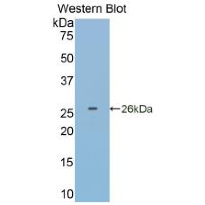 Glutathione S Transferase Pi (GSTp) Human Monoclonal Antibody