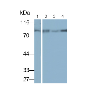 Alkaline Phosphatase, Tissue-nonspecific (ALPL) Human Monoclonal Antibody