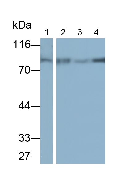 Alkaline Phosphatase, Tissue-nonspecific (ALPL) Human Monoclonal Antibody