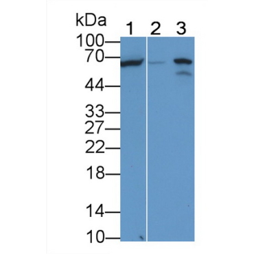 Alkaline Phosphatase, Tissue-nonspecific (ALPL) Human Monoclonal Antibody