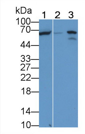 Alkaline Phosphatase, Tissue-nonspecific (ALPL) Human Monoclonal Antibody