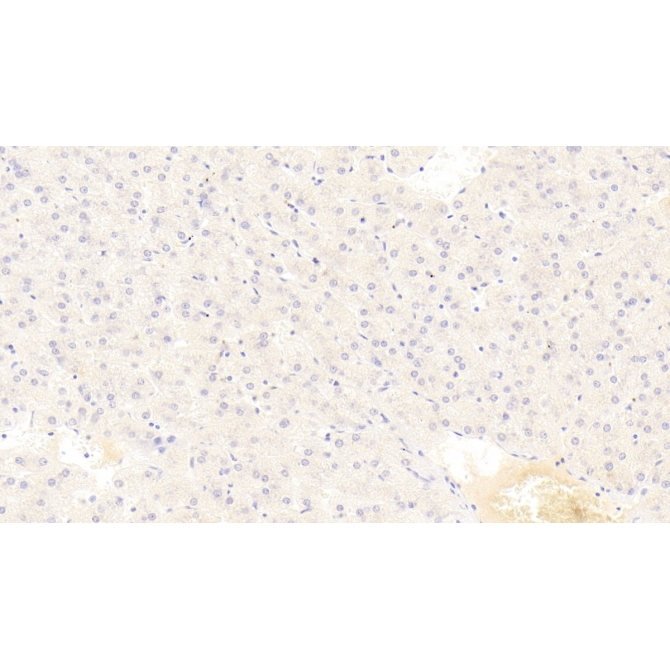Alkaline Phosphatase, Tissue-nonspecific (ALPL) Human Monoclonal Antibody