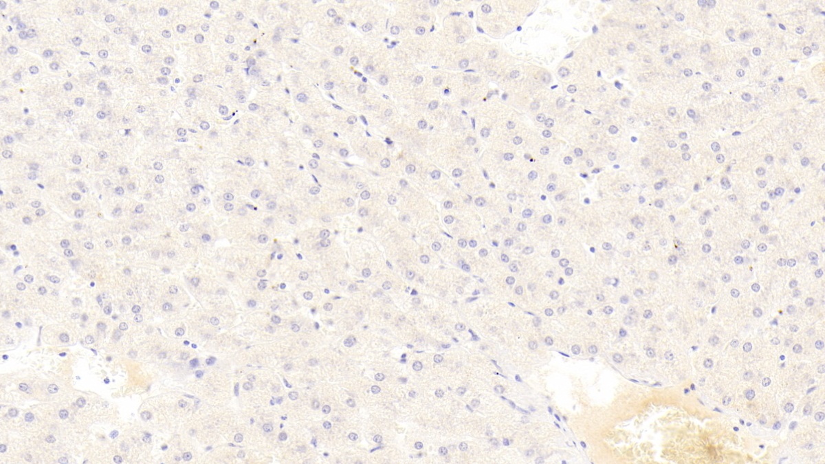 Alkaline Phosphatase, Tissue-nonspecific (ALPL) Human Monoclonal Antibody