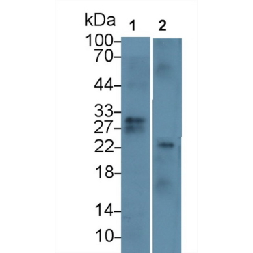 Cluster Of Differentiation 8a (CD8a) Human Monoclonal Antibody