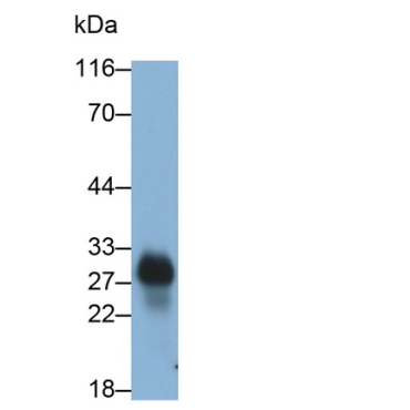 Cluster Of Differentiation 8a (CD8a) Human Monoclonal Antibody