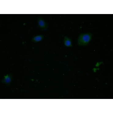 Arginase (ARG) Human Monoclonal Antibody