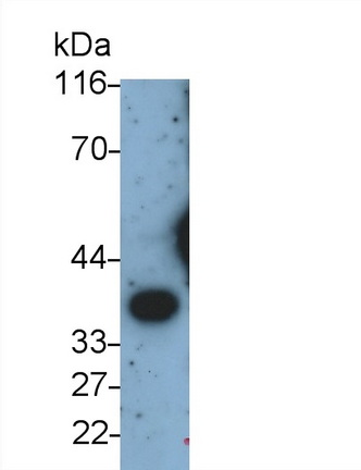 Arginase (ARG) Rat Monoclonal Antibody