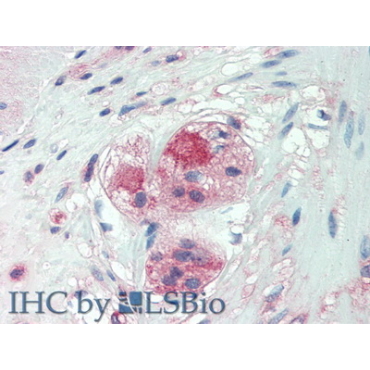 Chondroitin Sulfate Proteoglycan 4 (CSPG4) Human Monoclonal Antibody
