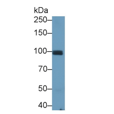 Cadherin, Osteoblast (CDHOB) Human Monoclonal Antibody