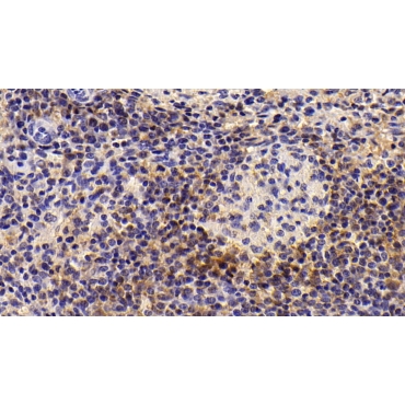 Integrin Alpha X (CD11c) Human Monoclonal Antibody