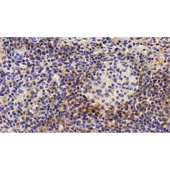 Integrin Alpha X (CD11c) Human Monoclonal Antibody