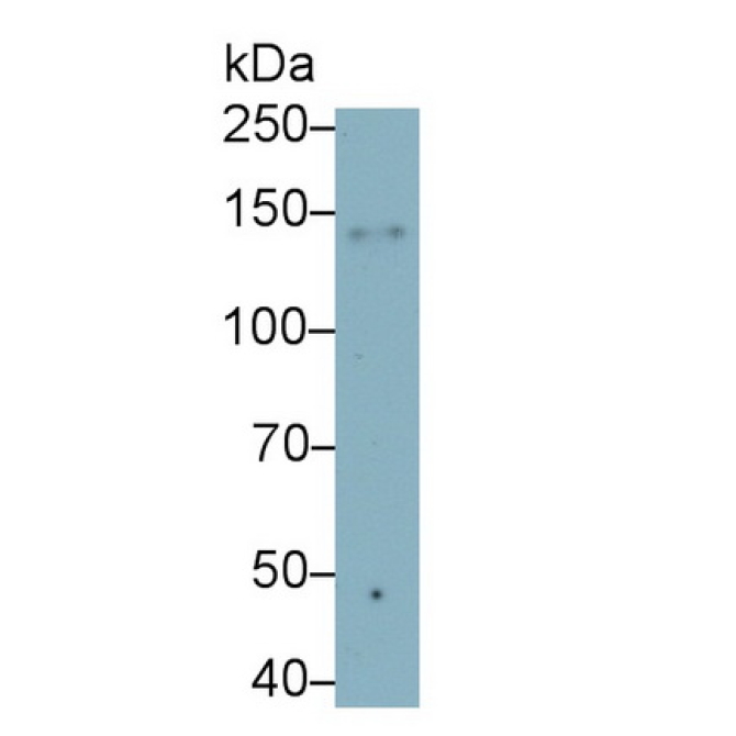 Integrin Alpha X (CD11c) Human Monoclonal Antibody
