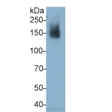 Integrin Alpha X (CD11c) Human Monoclonal Antibody