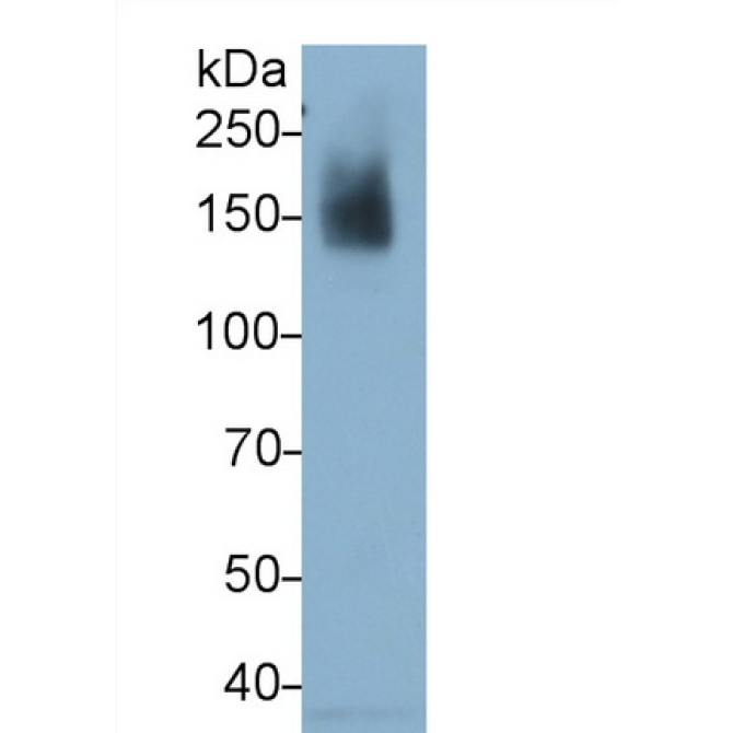 Integrin Alpha X (CD11c) Human Monoclonal Antibody