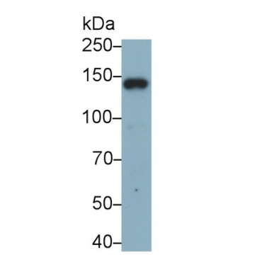 Integrin Alpha X (CD11c) Human Monoclonal Antibody