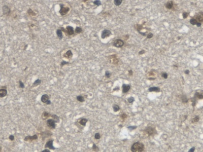 VGF Nerve Growth Factor Inducible (VGF) Human Monoclonal Antibody
