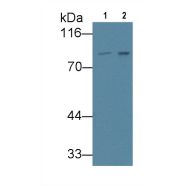 VGF Nerve Growth Factor Inducible (VGF) Human Monoclonal Antibody