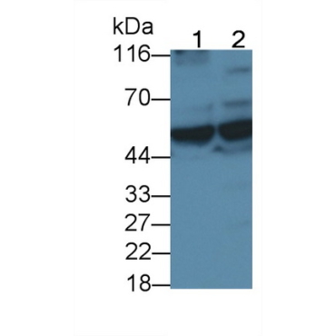 Cluster Of Differentiation 4 (CD4) Human Monoclonal Antibody