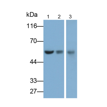 Cluster Of Differentiation 4 (CD4) Human Monoclonal Antibody