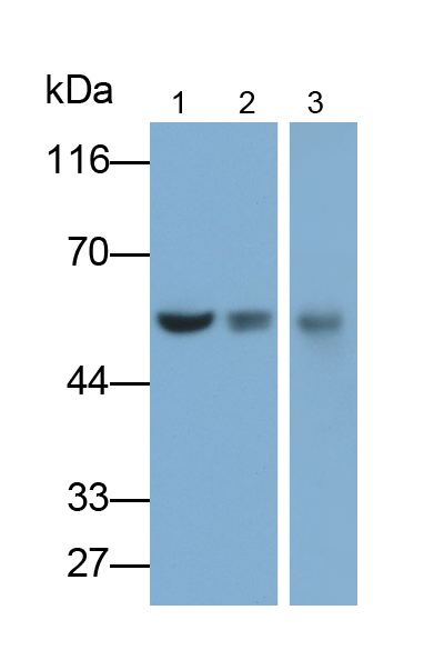 Cluster Of Differentiation 4 (CD4) Human Monoclonal Antibody