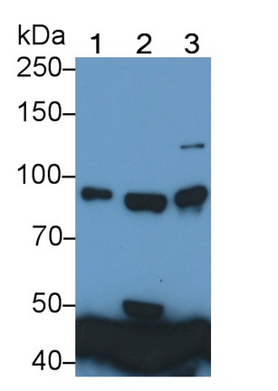 Transferrin Receptor (TFR) Human Monoclonal Antibody