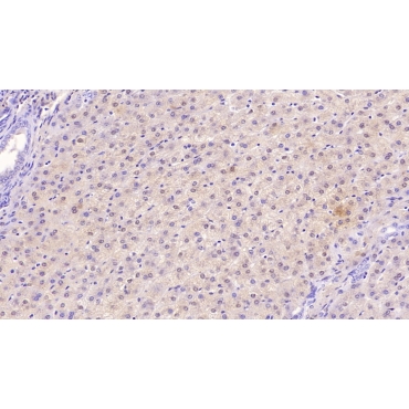 Transferrin Receptor (TFR) Human Monoclonal Antibody