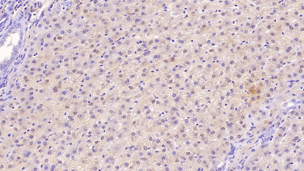 Transferrin Receptor (TFR) Human Monoclonal Antibody