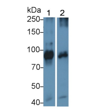Transferrin Receptor (TFR) Human Monoclonal Antibody